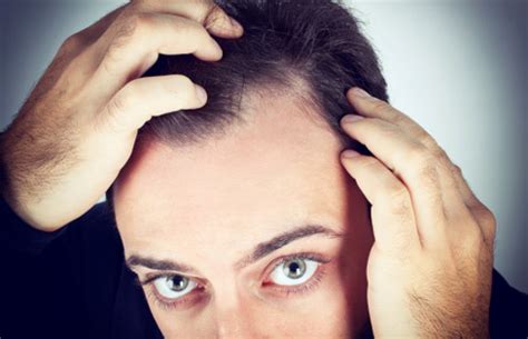 Hypothyroidism causes hair loss because the slowing down of the metabolism affects scalp follicles and results in diminished hair strength and quality. Does Thyroid Disease Cause Hair Loss?
