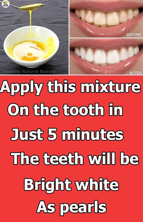 Pin On Natural Tooth Whitening