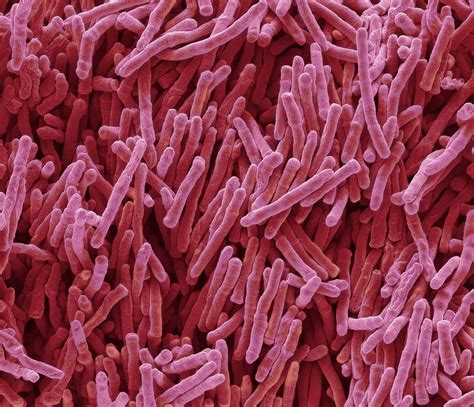 Mycobacterium Smegmatis Bacteria Photograph By Steve Gschmeissner