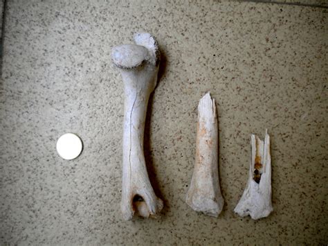 Bone Broke Posts On Archaeology Osteology And Biological Anthropology
