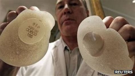 Pip Implants Over 2800 Referred For Nhs Care Bbc News
