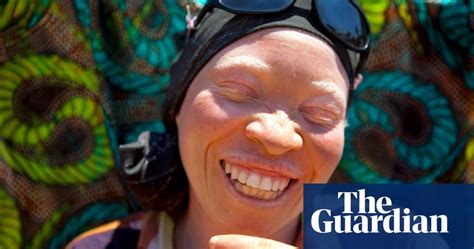 Albinism In Tanzania Safe Havens In Schools And Support Centres In