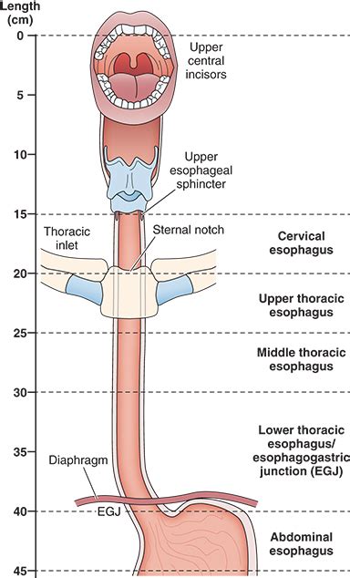 Esophageal Procedures Anesthesia Key