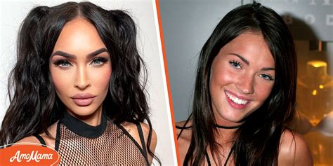 Did Megan Fox Ever Have Plastic Surgery Done Experts Weigh In