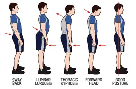 Benefits Of Good Posture