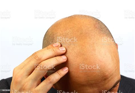 Bald Man Head Stock Photo Download Image Now Istock