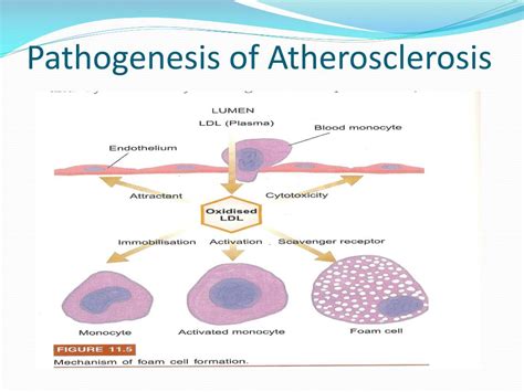 Ppt Pathophysiology Of Atherosclerosis Powerpoint Presentation Free