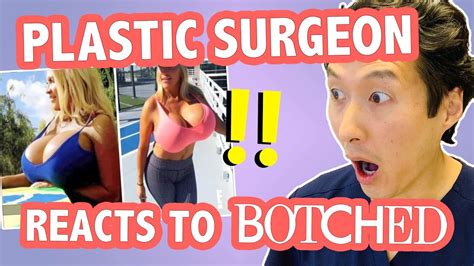 The Largest Breast Implants Ever Plastic Surgeon Reacts To Botched Youtube