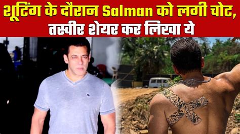 Salman Khan Got Hurt During The Shooting Shared The Picture And Wrote