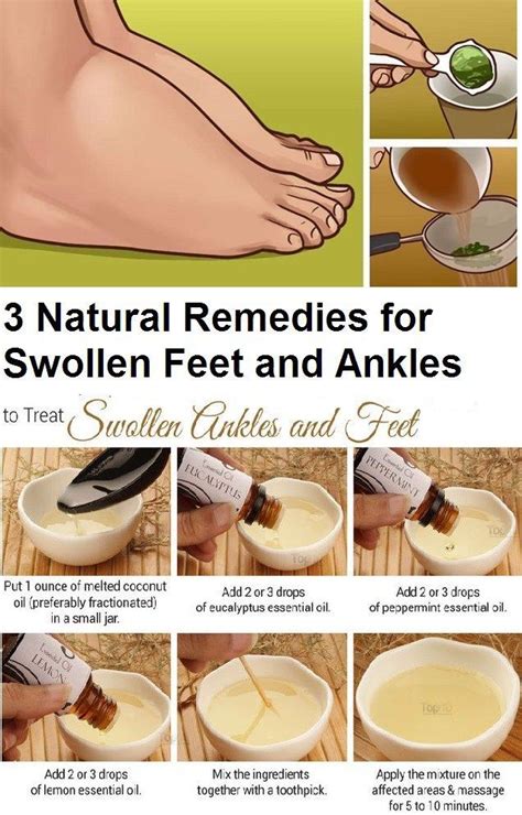 3 Natural Remedies For Swollen Feet And Ankles Try Some Of These Natural Remedies And Get Rid Of