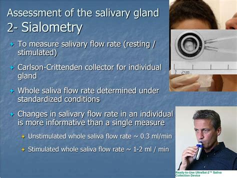 Ppt Salivary Gland Disease Powerpoint Presentation Free Download