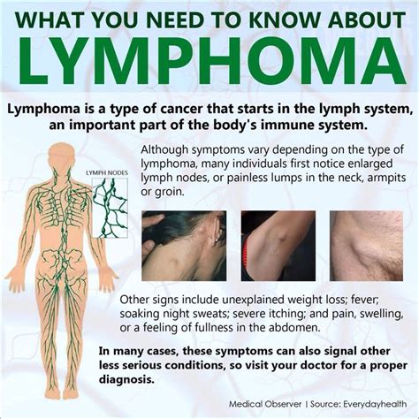 Lymphoma Oncology Nursing Hematology Lymphoma Cancer