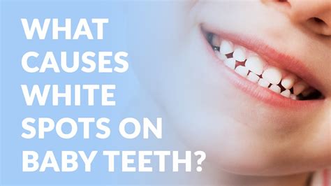 What Causes White Spots On Baby Teeth Ac Pediatric Dentistry