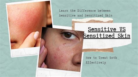 Sensitive Vs Sensitized Skin Causes And Treatment Youtube