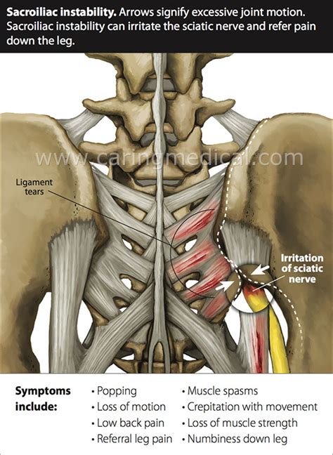 Your skeletal muscles generally work in opposing pairs or groups at a given. Tight Muscles In Lower Back And Hip Area : Psoas Talk With Christye Volt Blog / Do you have ...