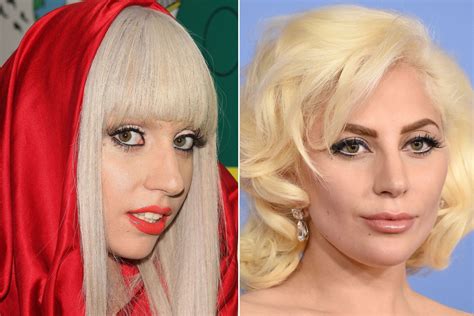 The Changing Face Of Lady Gaga Page Six