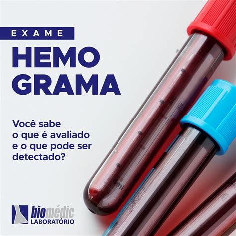 Laborat Rio Biom Dic Exame Hemograma