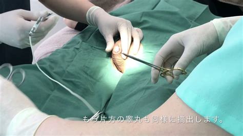 12 性 転換 手術 男性 から 女性 写真 Lates