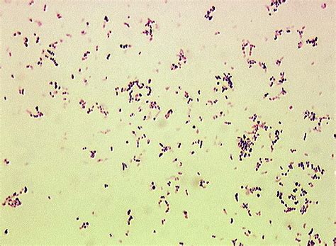 Gram Positive Coccobacilli Microbiology Learning The Whyology Of