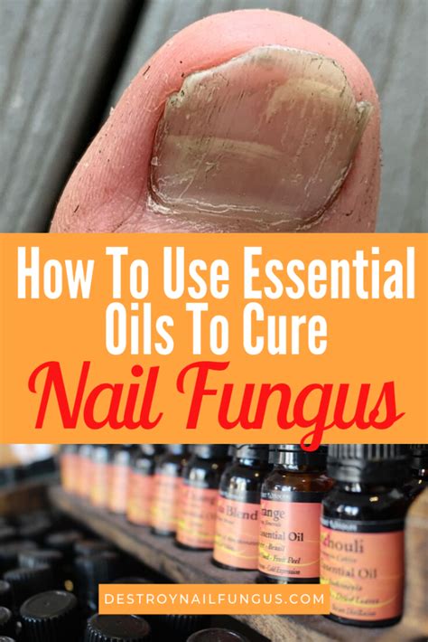 Each of these oils has specific healing properties that can help to kill a fungal infection and remove its. The 8 Best Essential Oils For Toenail Fungus: What You ...