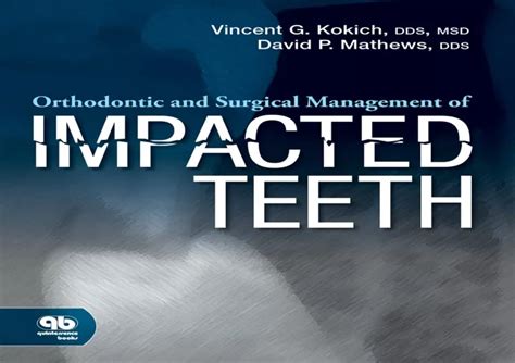 Ppt Pdf Orthodontic And Surgical Management Of Impacted Teeth Full