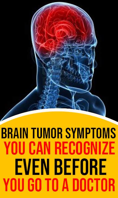 Brain Tumor Symptoms You Can Recognize Even Before You Go To A Doctor