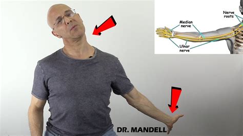 Stretch Away Nerve Pain In Neck Arm Carpal Tunnel Syndrome Dr Alan
