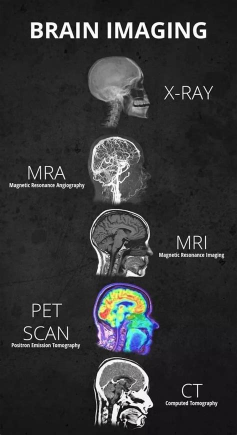 Brain Imaging Techniques Psychology Brainlyvi