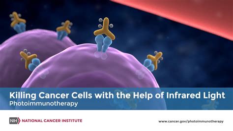 Killing Cancer Cells With The Help Of Infrared Light