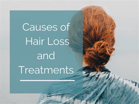 Top Image Causes Of Hair Loss Women Thptnganamst Edu Vn