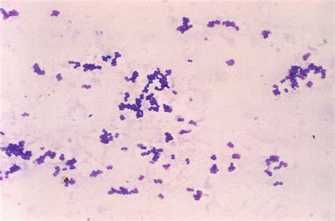 Public Domain Picture Aerococcus Species Gram Stain Id