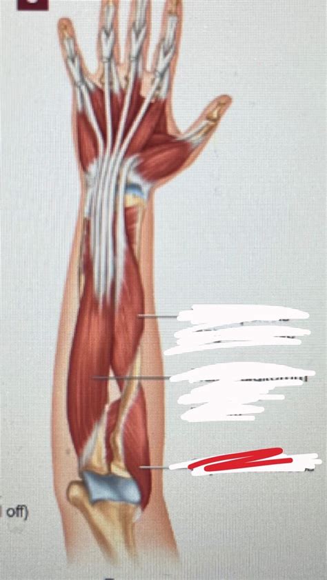 Lab 7 Deep Forearm Muscles Anterior View Diagram Quizlet