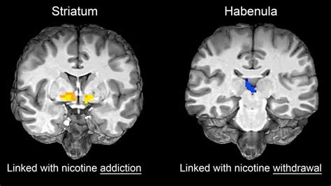 What Does Nicotine Do To The Brain Addict Advice