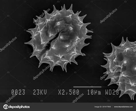 Daisy Pollen Under Electron Microscope Stock Photo By ©bearacreative