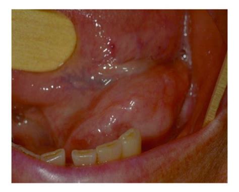 Floor Of Mouth Swollen Review Home Decor