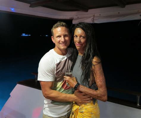 Turia Pitt And Michael Hoskin Love Story In Pictures