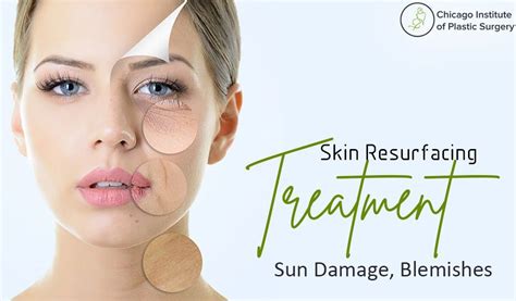 Skin Resurfacing Treatments Minimize Blemishes Treat Sun Damage