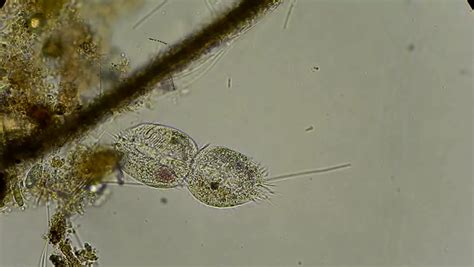 These are organelles pertinent to plant cells. Full HD. Motion Of Single-celled Animals (infusoria) Under ...