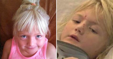 6 Year Old Nearly Sliced In Half Parents Urge Others Not To Make The