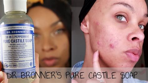 I Tried Dr Bronners Pure Castile Soap For One Week Acne Prone Skin