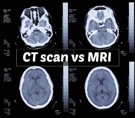 Wat Is Het Verschil Tussen Mri En Ct Medisch Spectrum Twente Zohal