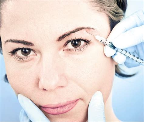 Everything Youve Ever Wanted To Know About Botox And Fillers Ideas