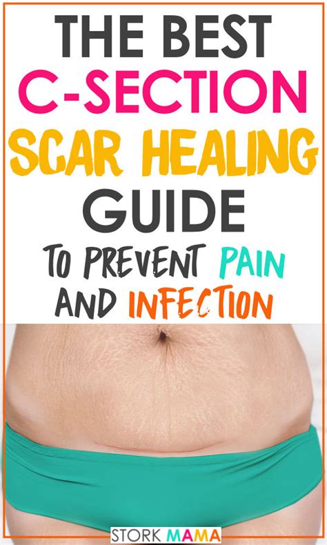 C Section Scar Healing Care Guide Stork Mama