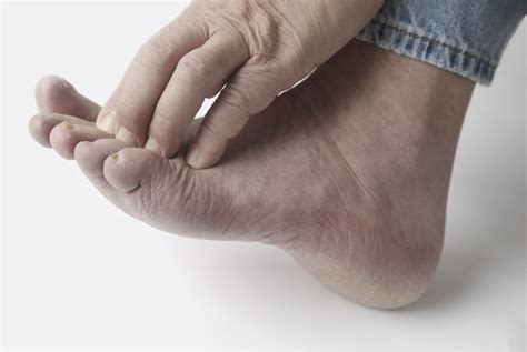 North Texas Foot And Ankle Now Helps Diabetics With Foot Problems