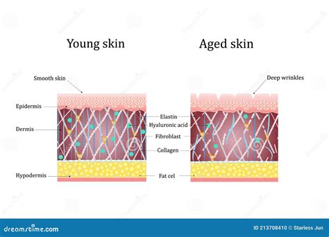 Vector Illustration Of Age Related Changes In The Skin Comparison Of