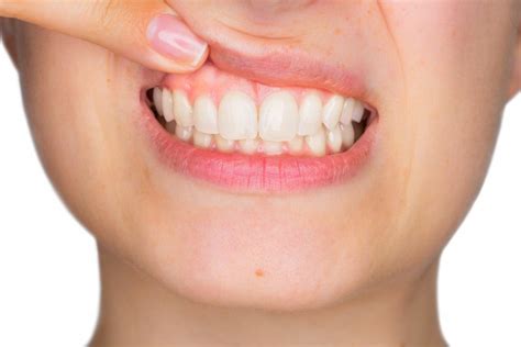 6 Tips For Healthy Gums Canton Robison Dental Group