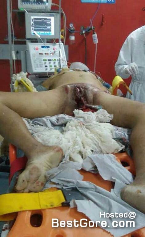 Cheating Husband Gets His Dick And Balls Cut Off By Wife