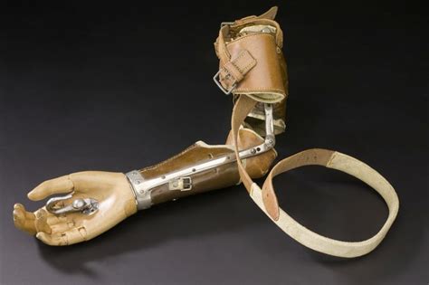 The History Of Prosthetics Reveals A Long Tradition Of Human Cyborgs