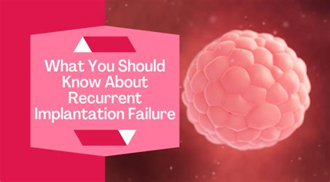 What You Should Know About Recurrent Implantation Failure