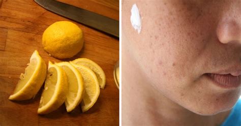 10 Things You Should Never Put On Your Face Number 9 Will Completely